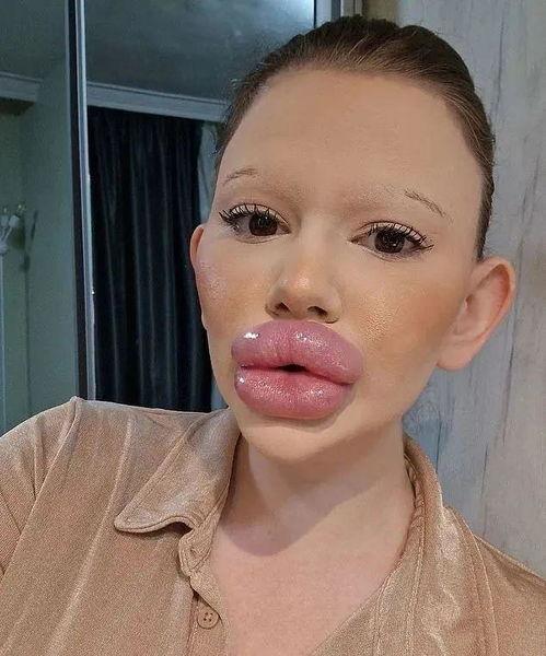 嘴唇厚的网红,揭秘网红厚唇的独特风采